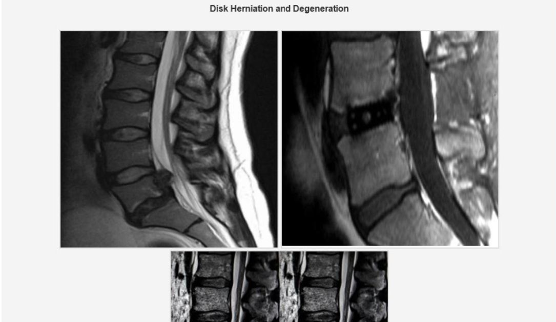Iranian cyber spies used fake MRI scan results to hack ‘enemy of regime’